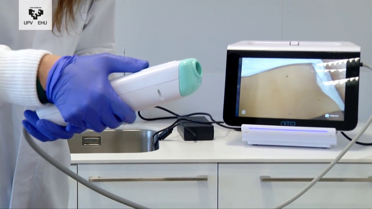 Proyecto Astonish "diagnóstico óptico del melanoma"